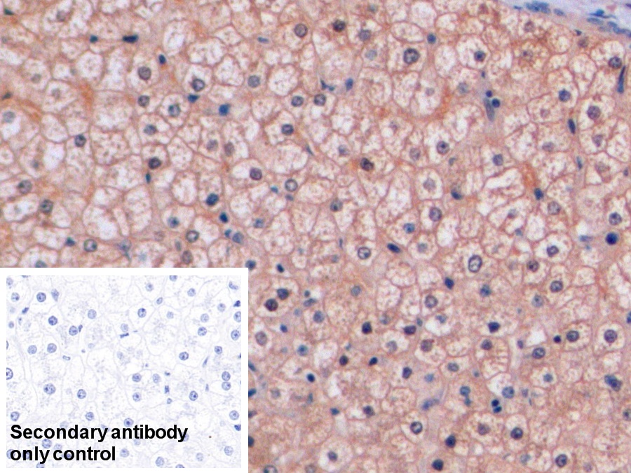 Polyclonal Antibody to Thymidylate Synthetase (TYMS)