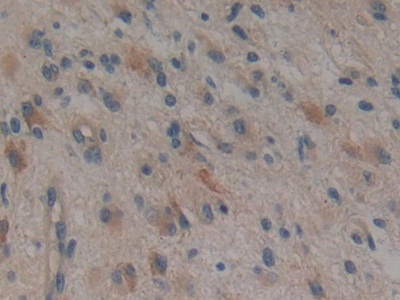 Polyclonal Antibody to TTK Protein Kinase (TTK)