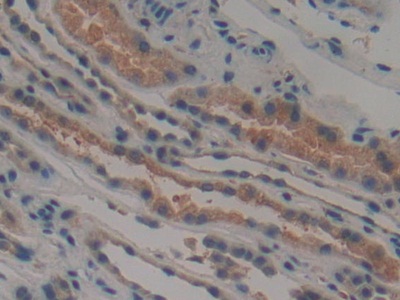 Polyclonal Antibody to TTK Protein Kinase (TTK)