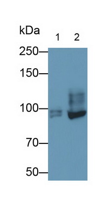 Polyclonal Antibody to TTK Protein Kinase (TTK)