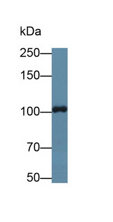 Polyclonal Antibody to TTK Protein Kinase (TTK)