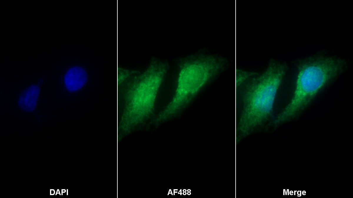 Polyclonal Antibody to TTK Protein Kinase (TTK)