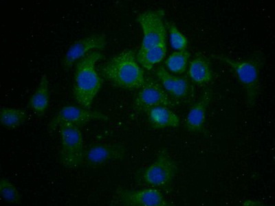 Polyclonal Antibody to TTK Protein Kinase (TTK)