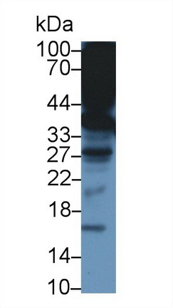 Polyclonal Antibody to Alpha-Tocopherol Transfer Protein (TTPa)