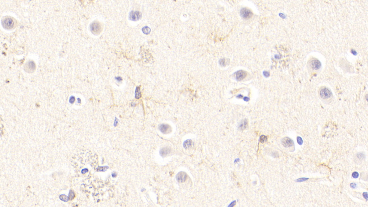 Polyclonal Antibody to Transformation/Transcription Domain Associated Protein (TRRAP)