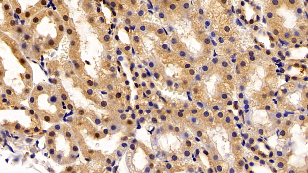 Polyclonal Antibody to Transketolase (TKT)