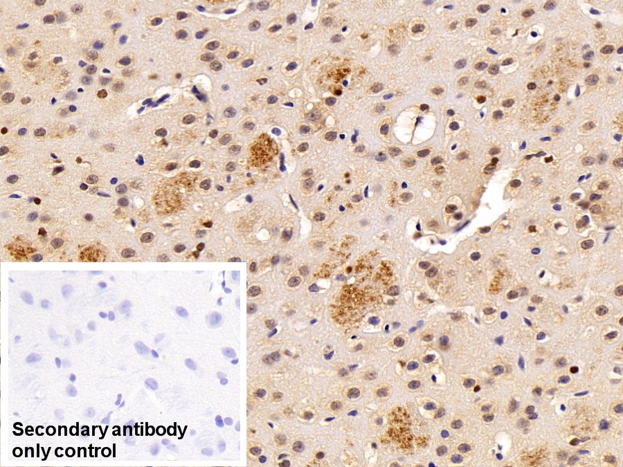 Polyclonal Antibody to Transketolase (TKT)