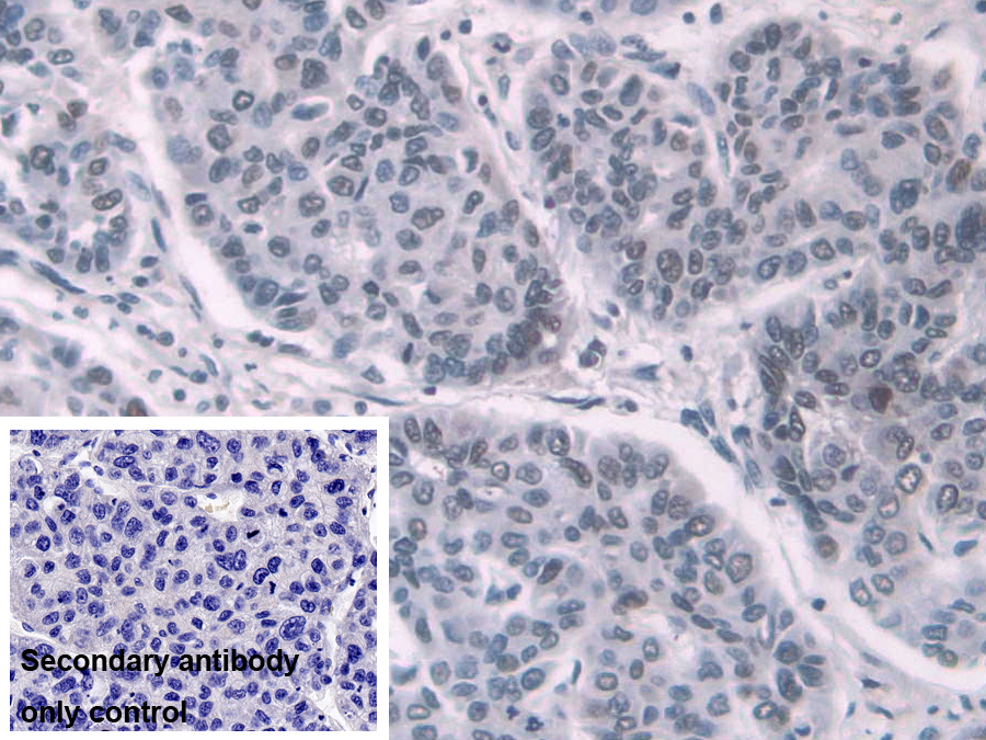 Polyclonal Antibody to Transketolase (TKT)