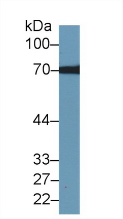 Polyclonal Antibody to Transketolase (TKT)