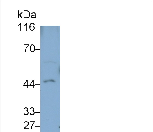 Polyclonal Antibody to Transforming Growth Factor Beta 1 Induced Transcript 1 (TGFb1I1)