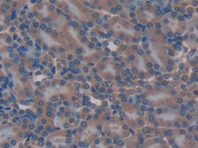 Polyclonal Antibody to Transcription Factor A, Mitochondrial (TFAM)