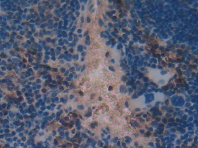 Polyclonal Antibody to Transcription Factor A, Mitochondrial (TFAM)