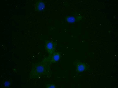 Polyclonal Antibody to Transcription Factor A, Mitochondrial (TFAM)