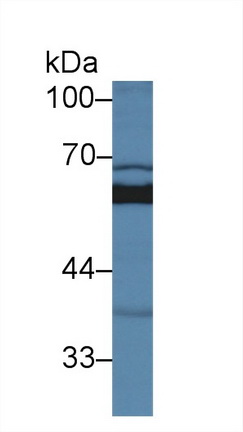 Polyclonal Antibody to Sulfite Oxidase (SUOX)