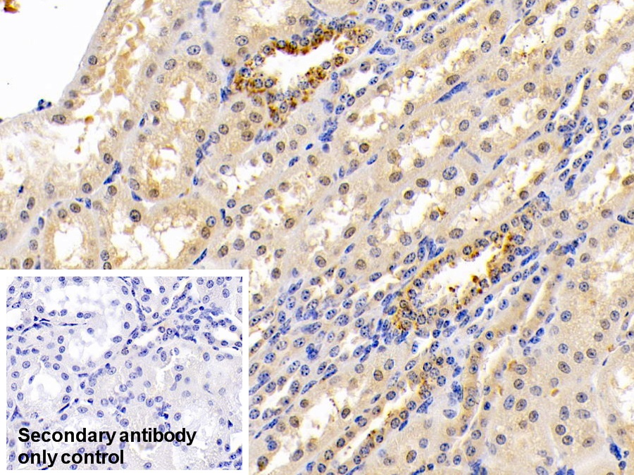 Polyclonal Antibody to Sulfite Oxidase (SUOX)