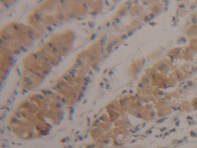 Polyclonal Antibody to Sulfite Oxidase (SUOX)