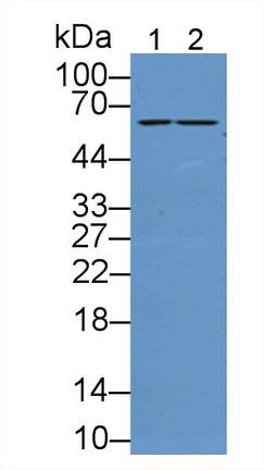 Polyclonal Antibody to Sulfite Oxidase (SUOX)