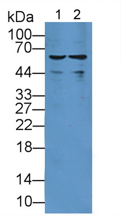 Polyclonal Antibody to Sulfite Oxidase (SUOX)