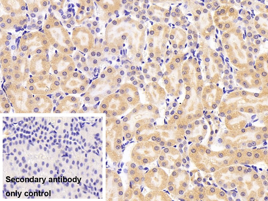 Polyclonal Antibody to Sulfite Oxidase (SUOX)