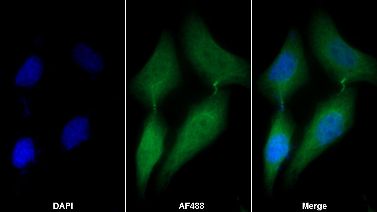 Polyclonal Antibody to Serine/Threonine Kinase 3 (STK3)