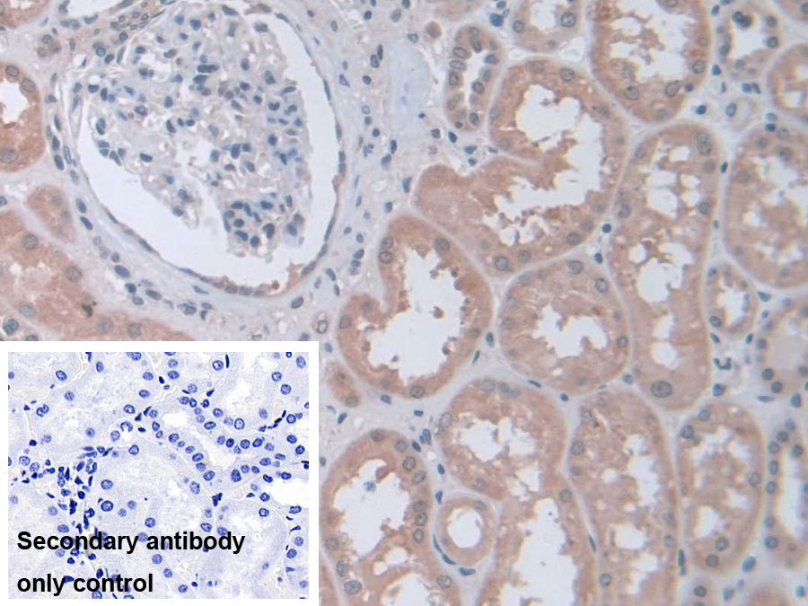 Polyclonal Antibody to Stress Induced Phosphoprotein 1 (STIP1)