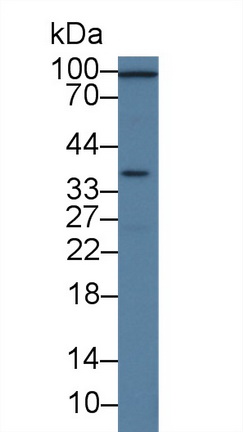 Polyclonal Antibody to Signal Transducing Adaptor Protein 1 (STAP1)