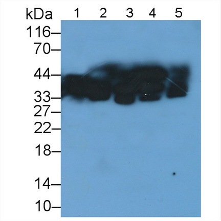 Polyclonal Antibody to Signal Transducing Adaptor Protein 1 (STAP1)