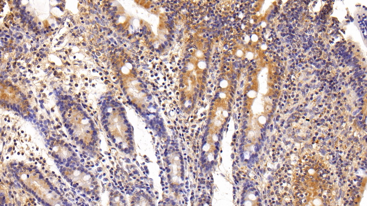 Polyclonal Antibody to Sorcin (SRI)