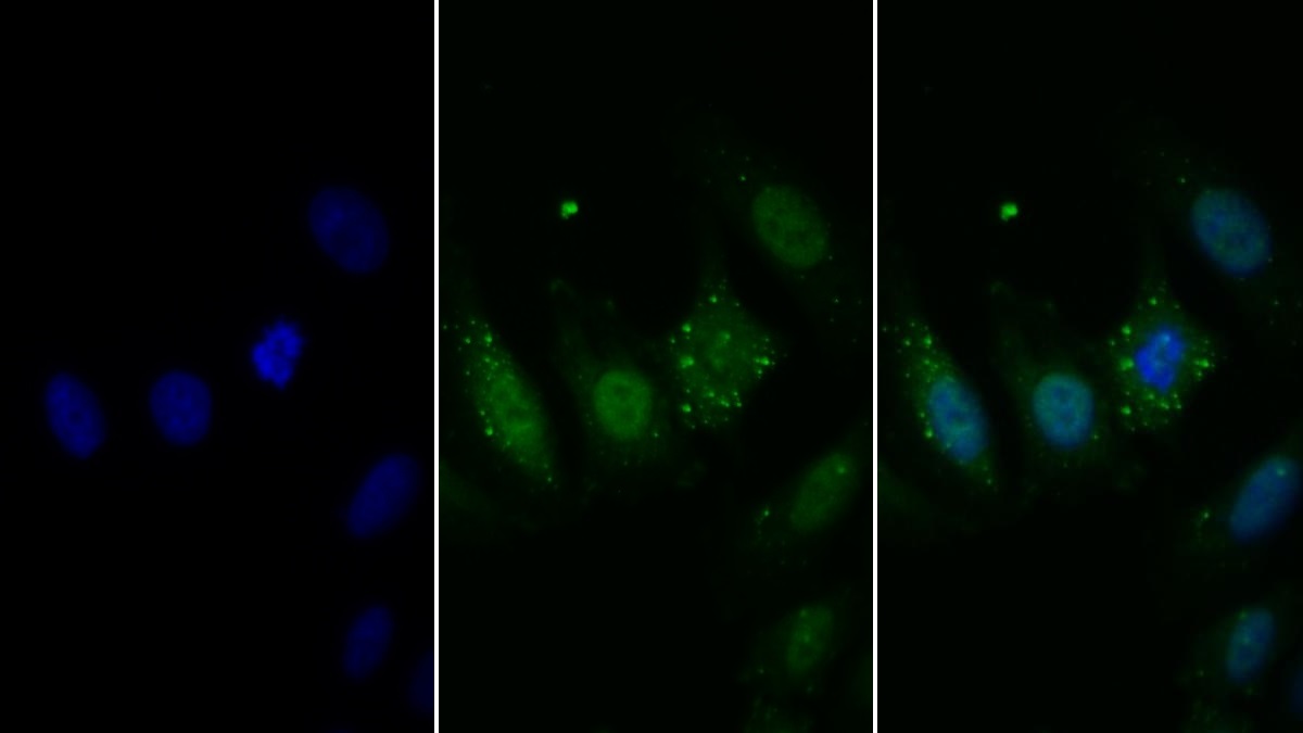 Polyclonal Antibody to Sorcin (SRI)