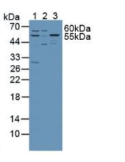 Polyclonal Antibody to Serine Palmitoyltransferase, Long Chain Base Subunit 1 (SPTLC1)