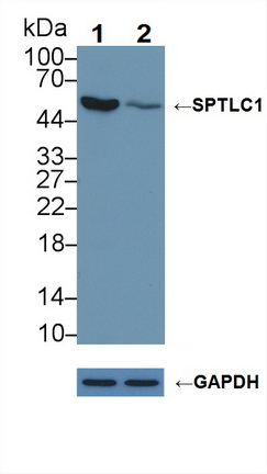 Polyclonal Antibody to Serine Palmitoyltransferase, Long Chain Base Subunit 1 (SPTLC1)