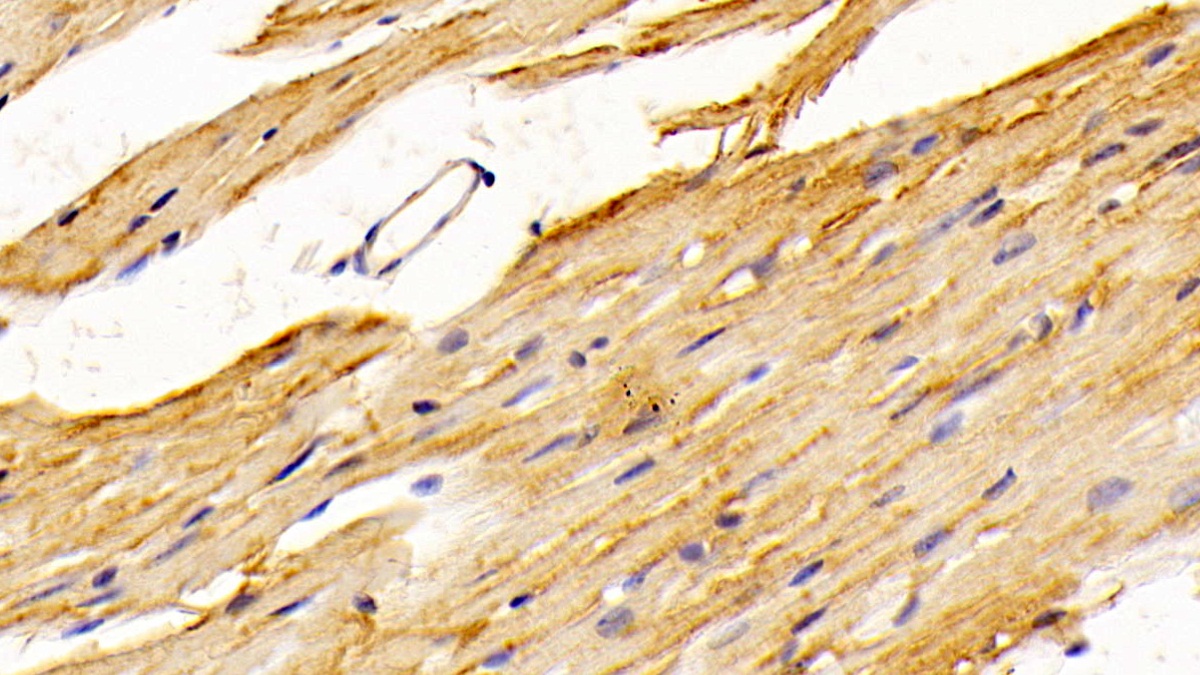 Polyclonal Antibody to Sepiapterin Reductase (SPR)