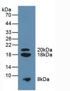 Polyclonal Antibody to Serine Peptidase Inhibitor Kazal Type 1 (SPINK1)