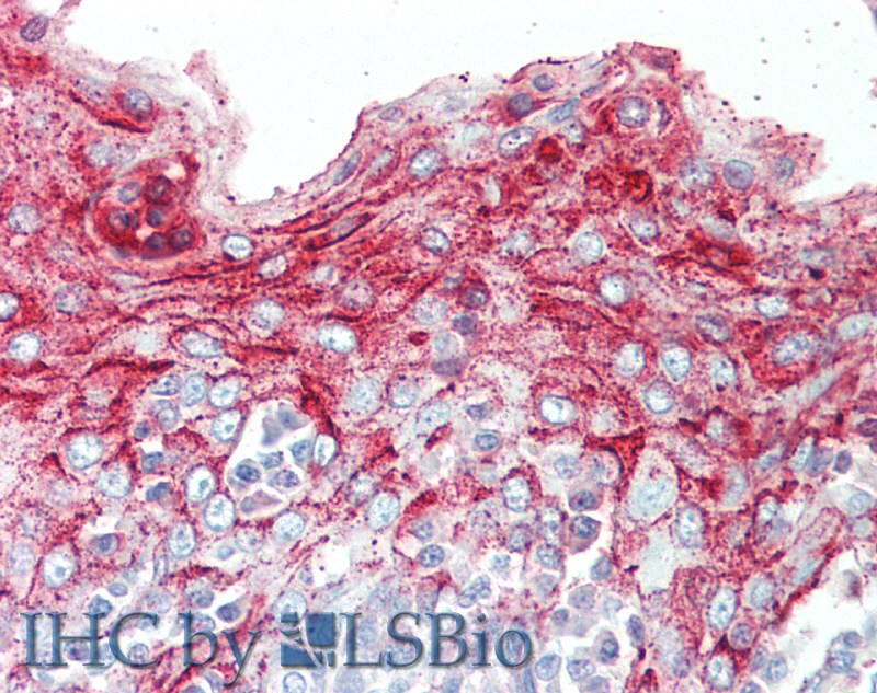 Polyclonal Antibody to Serine Peptidase Inhibitor Kazal Type 5 (SPINK5)