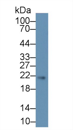 Polyclonal Antibody to Suppressors Of Cytokine Signaling 2 (SOCS2)