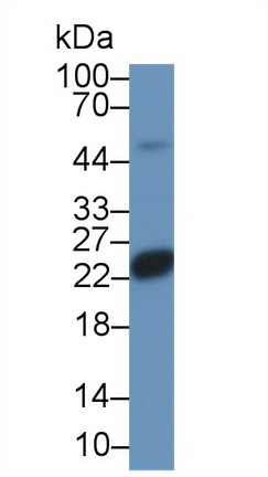 Polyclonal Antibody to Suppressors Of Cytokine Signaling 2 (SOCS2)