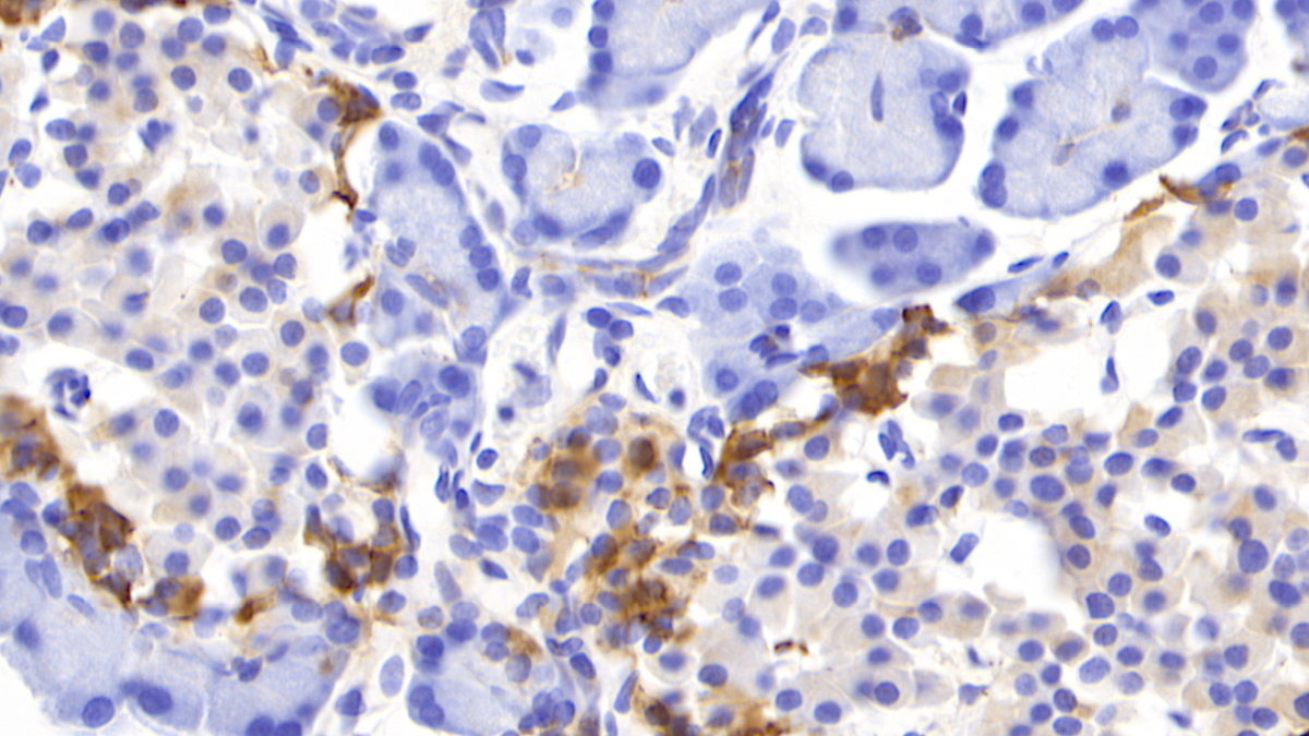 Polyclonal Antibody to Suppressors Of Cytokine Signaling 2 (SOCS2)