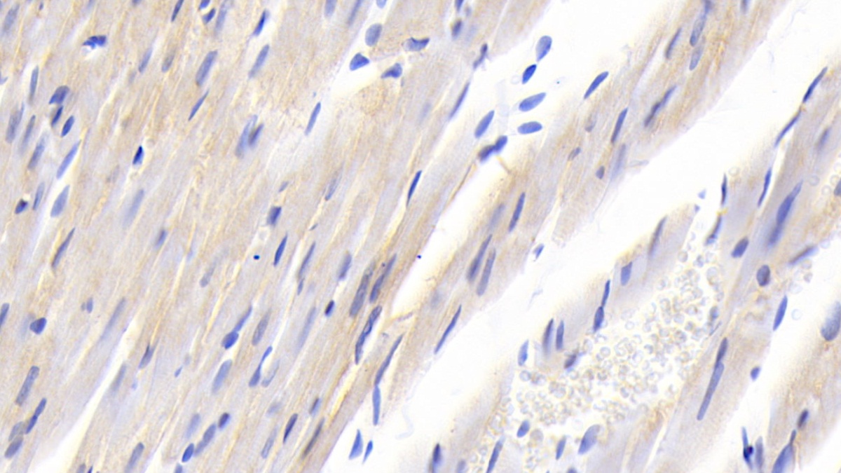 Polyclonal Antibody to Suppressors Of Cytokine Signaling 2 (SOCS2)