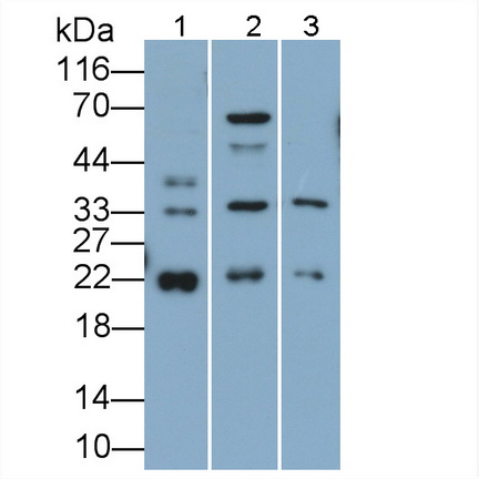 Polyclonal Antibody to Suppressors Of Cytokine Signaling 2 (SOCS2)