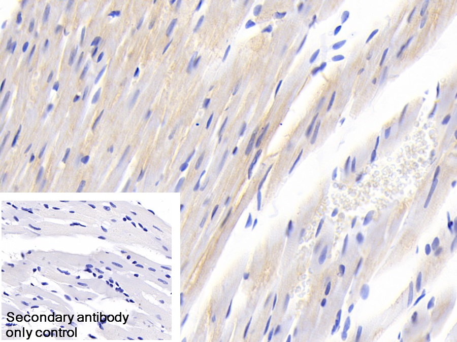 Polyclonal Antibody to Suppressors Of Cytokine Signaling 2 (SOCS2)