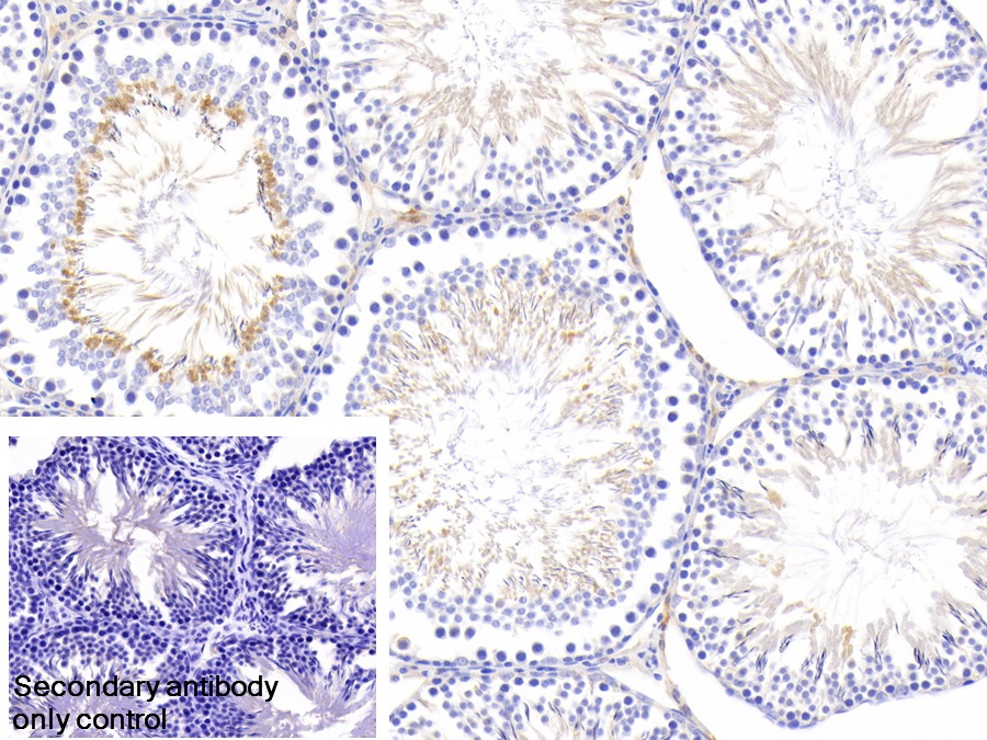 Polyclonal Antibody to Suppressors Of Cytokine Signaling 2 (SOCS2)