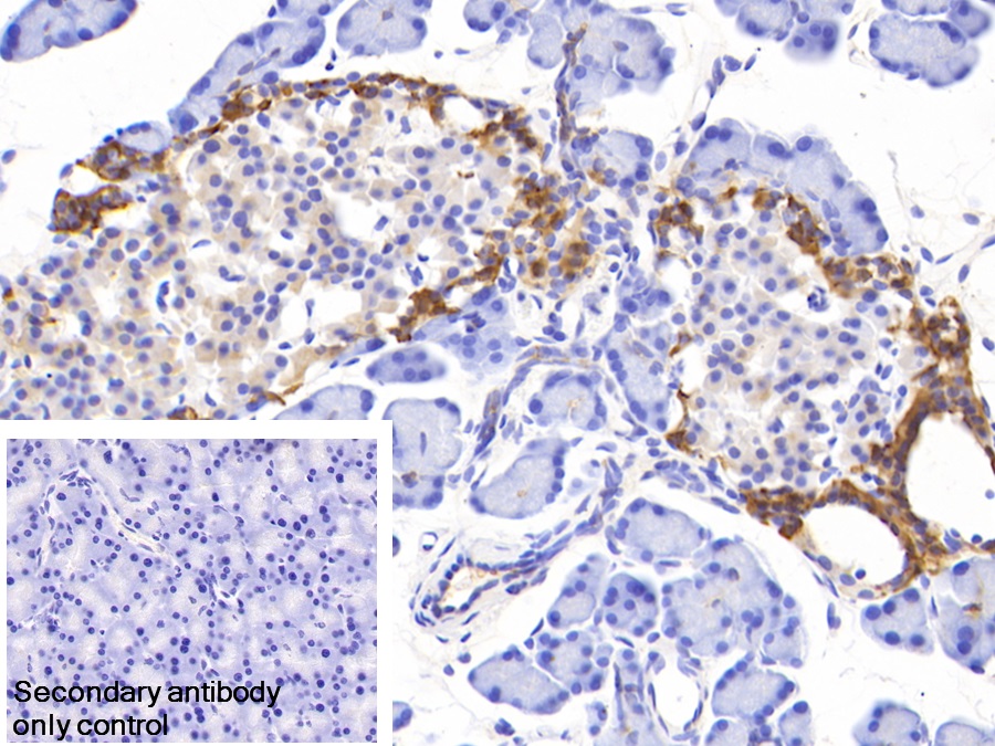 Polyclonal Antibody to Suppressors Of Cytokine Signaling 2 (SOCS2)