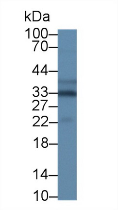 Polyclonal Antibody to Single Strand Selective Monofunctional Uracil DNA Glycosylase 1 (SMUG1)