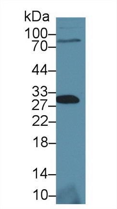 Polyclonal Antibody to Signaling Threshold Regulating Transmembrane Adaptor 1 (SIT1)