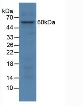 Polyclonal Antibody to N-Sulfoglucosamine Sulfohydrolase (SGSH)