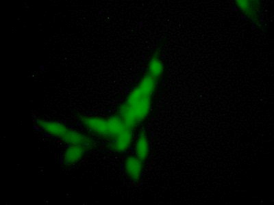 Polyclonal Antibody to N-Sulfoglucosamine Sulfohydrolase (SGSH)