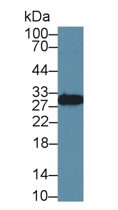 Polyclonal Antibody to Stratifin (SFN)