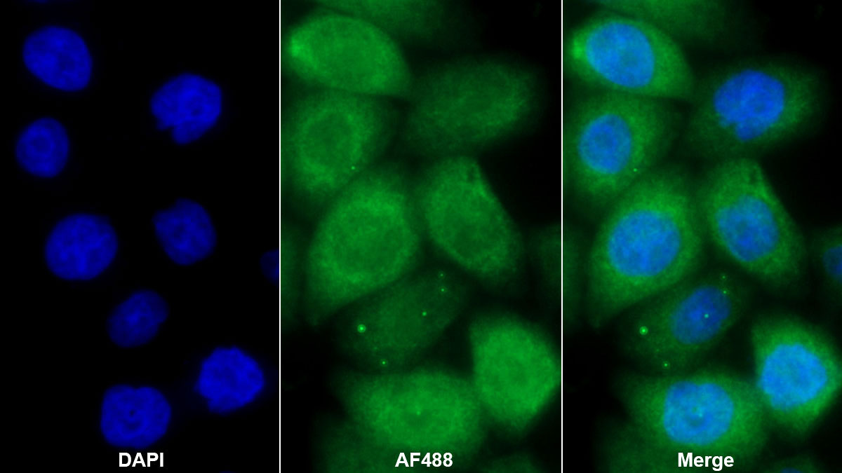 Polyclonal Antibody to Stratifin (SFN)