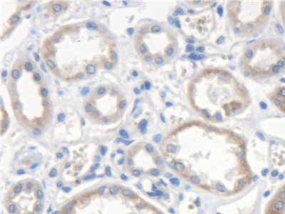 Polyclonal Antibody to Scavenger Receptor Class A Member 5 (SCARA5)