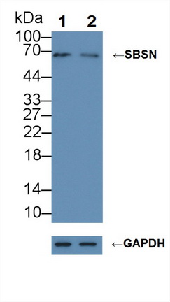 Polyclonal Antibody to Suprabasin (SBSN)